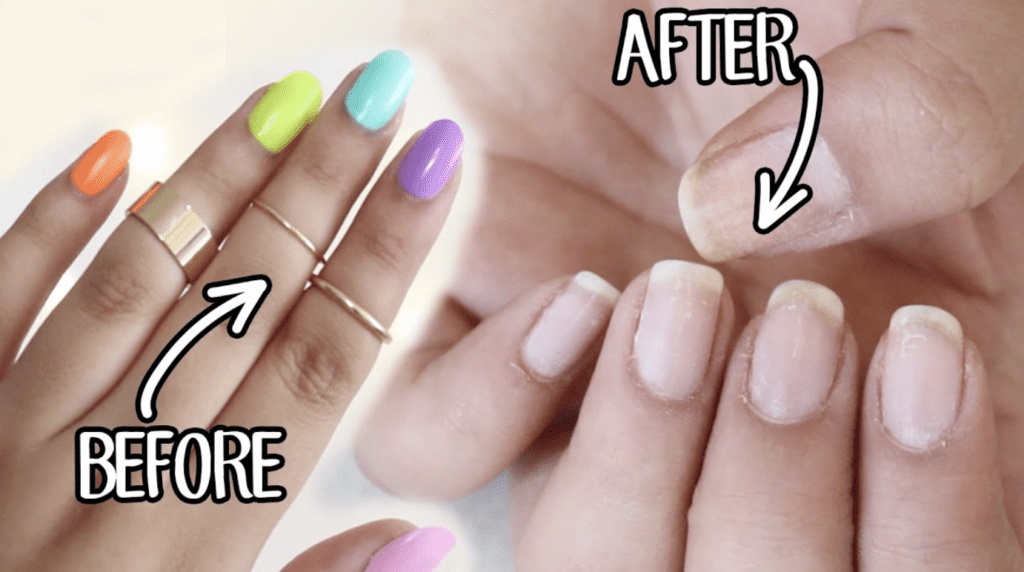 How to Remove Glue on Nails